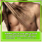 آیا زن از موی بدن مرد خوشش میاد؟